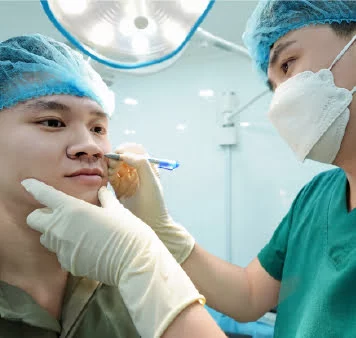 phẫu thuật thu gọn cánh mũi