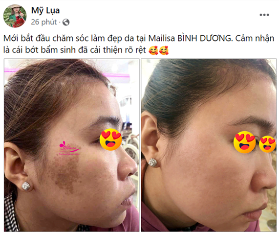 điều trị mụn thịt