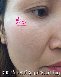 điều trị da