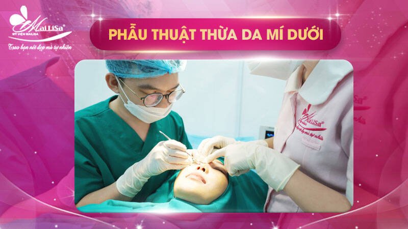 phau-thuat-thua-da-mi-duoi