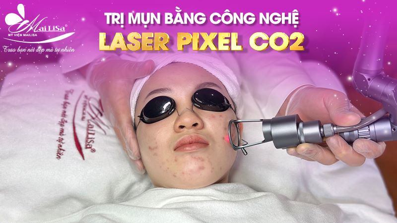 tri-mun-laser-co2-fac