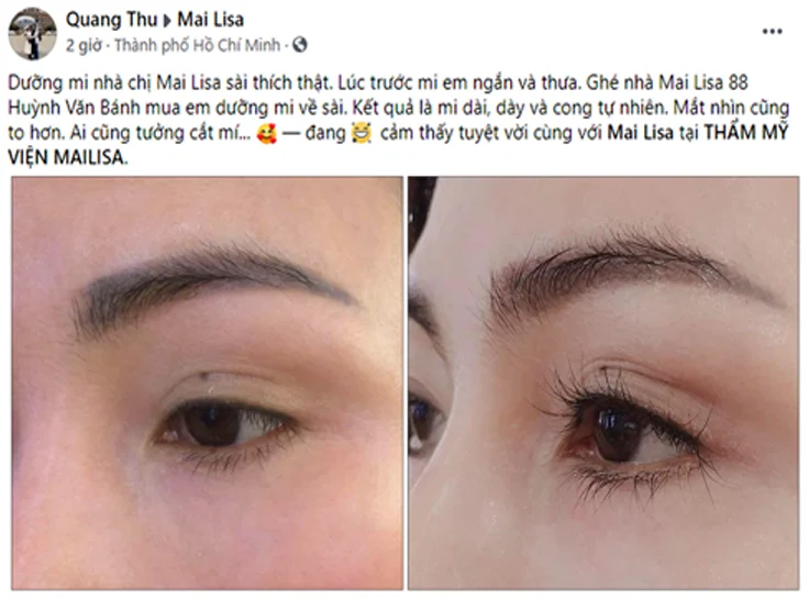 tinh chất dưỡng mailisa