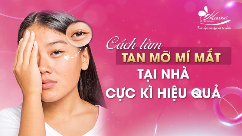 cách làm tan mỡ mí mắt