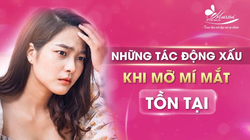 cách làm tan mỡ mí mắt