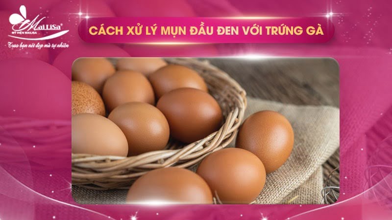 trị mụn cám ở mũi