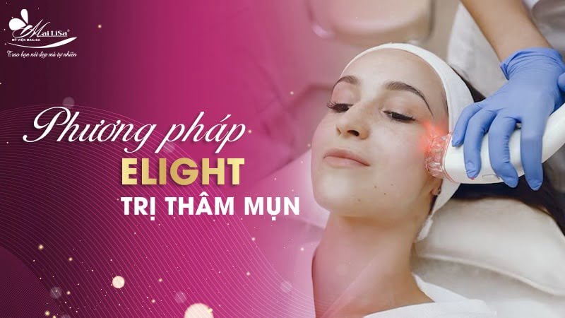 thâm mụn có tự hết không