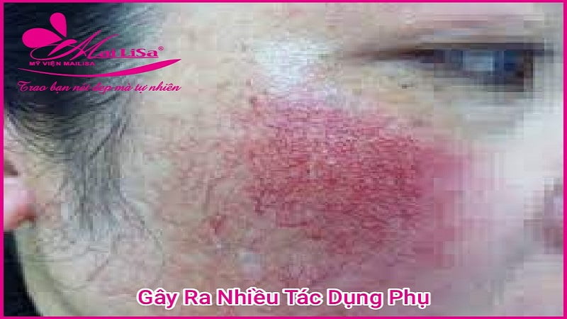 gay-tac-dung-phu