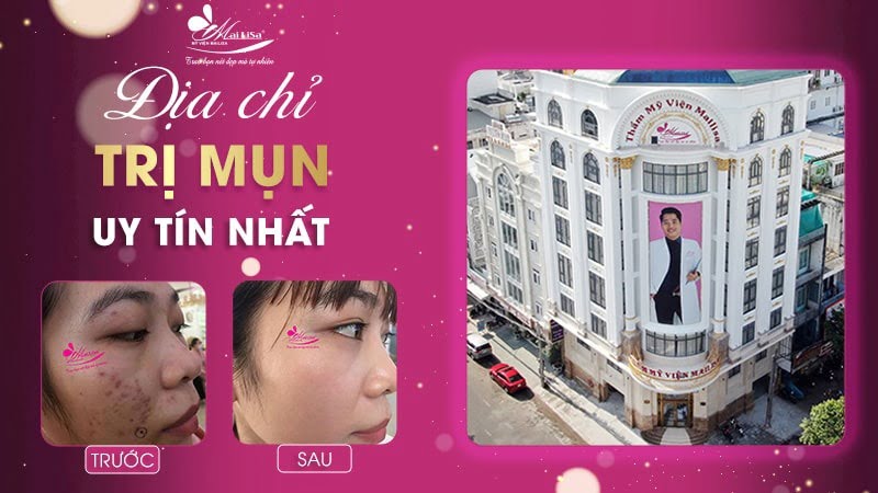 thâm mụn có tự hết không