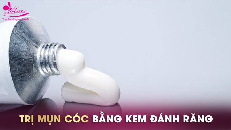 cách trị mụn cóc ở tay