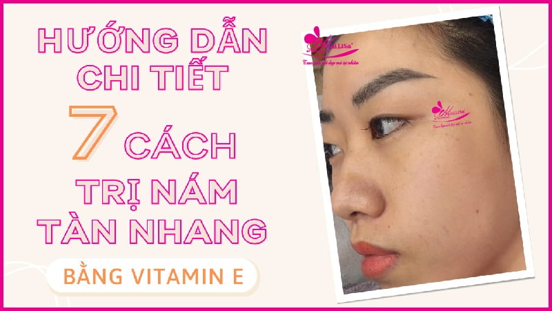 huong-dan-chi-tiet-cach-tri-nam