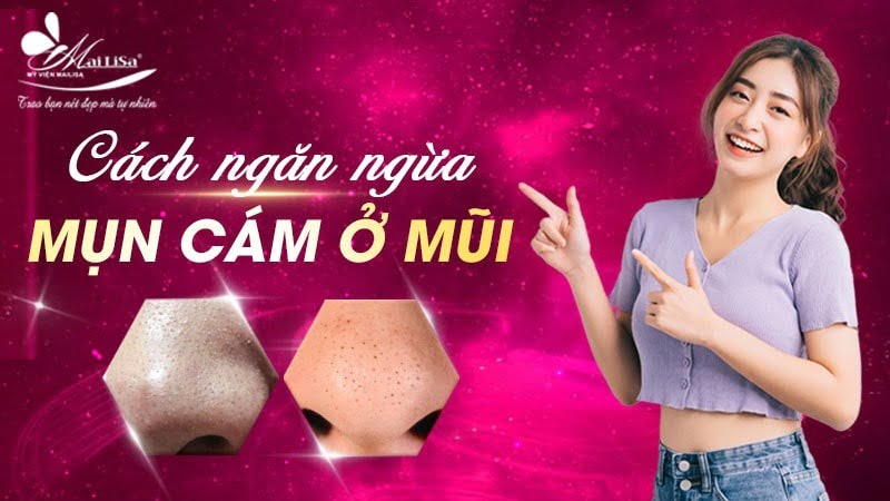 trị mụn cám ở mũi