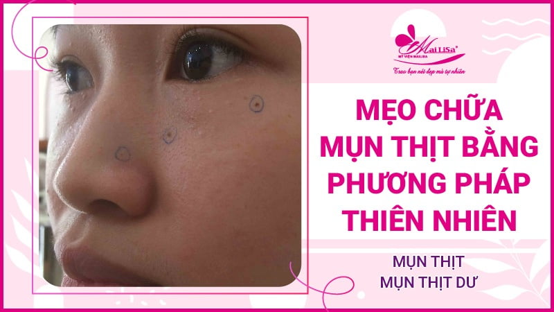 meo-chua-mun-thit