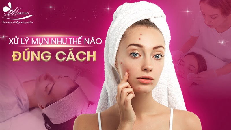 có nên nặn mụn không