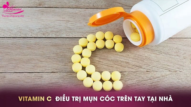 cách trị mụn cóc ở tay