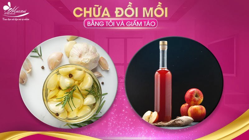 trị đồi mồi bằng tỏi