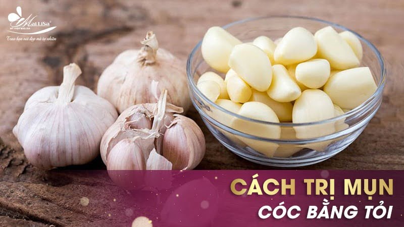 cách trị mụn cóc ở tay