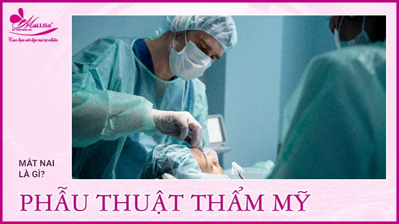 Phẫu thauatj tạo mắt nai