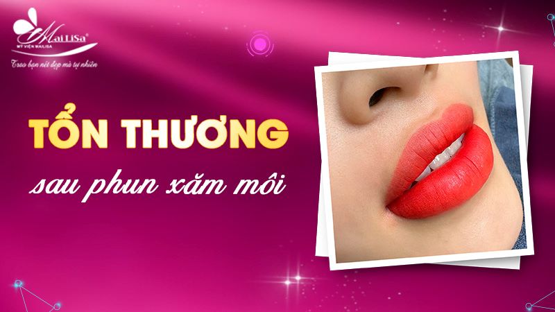 phun-moi-ton-thuong