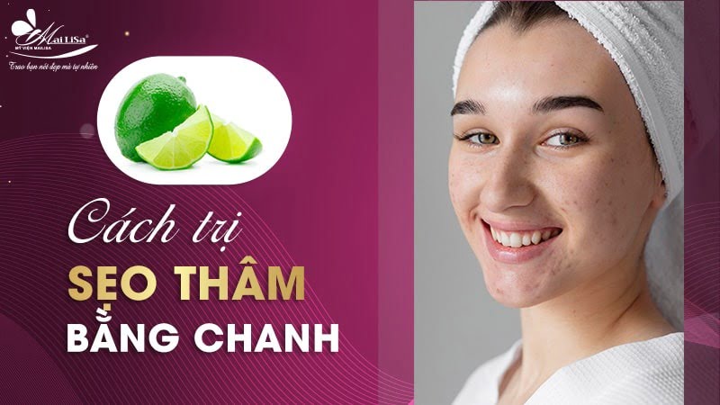 trị sẹo và thâm mụn