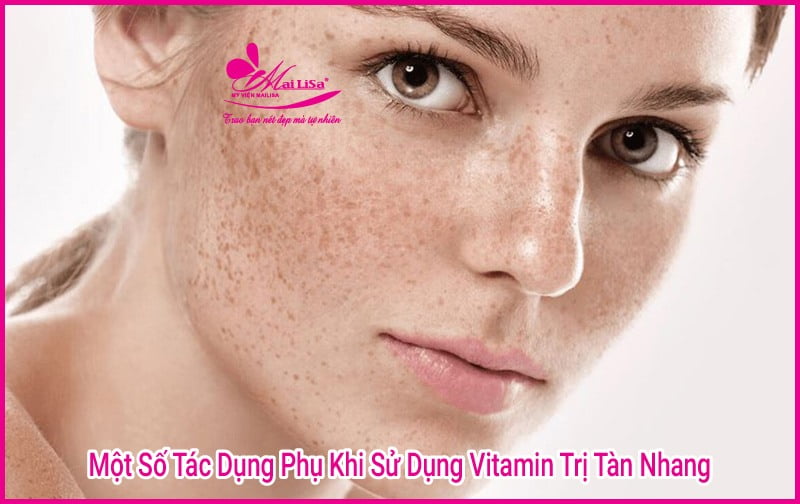 uống vitamin gì để trị tàn nhang