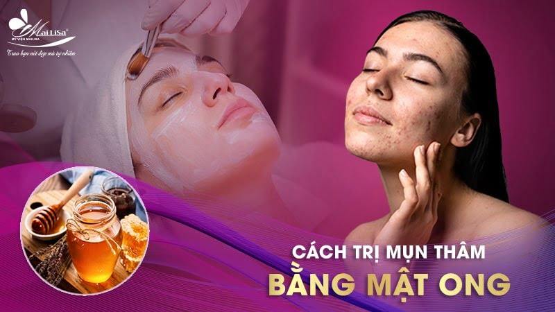 trị sẹo và thâm mụn