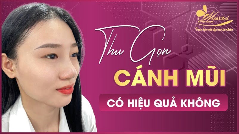 cánh mũi dày