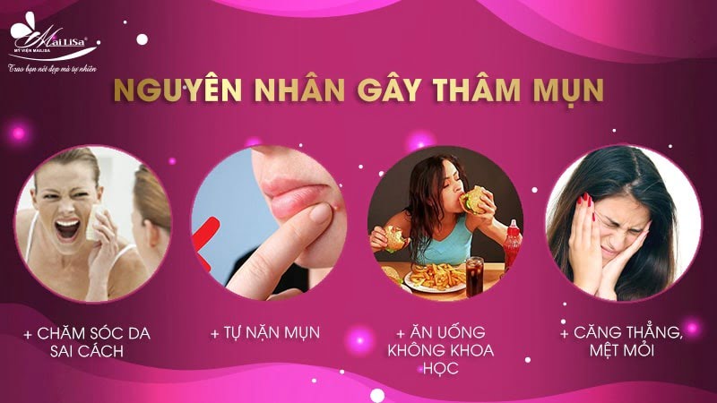 thâm mụn có tự hết không