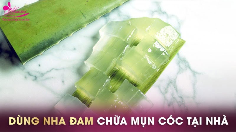 cách trị mụn cóc ở tay