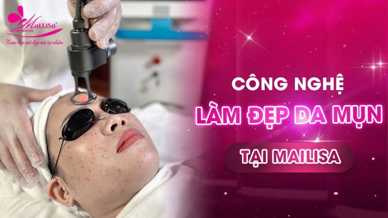 trị mụn cám ở mũi