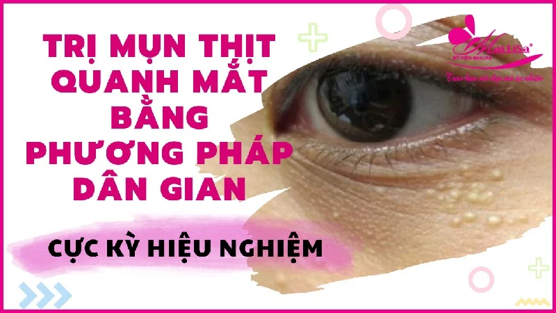 Lưu ý khi sử dụng phương pháp dân gian trị mụn thịt