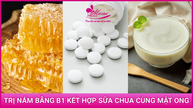 tri-nam-bang-vitamin-b1-va-sua-chua