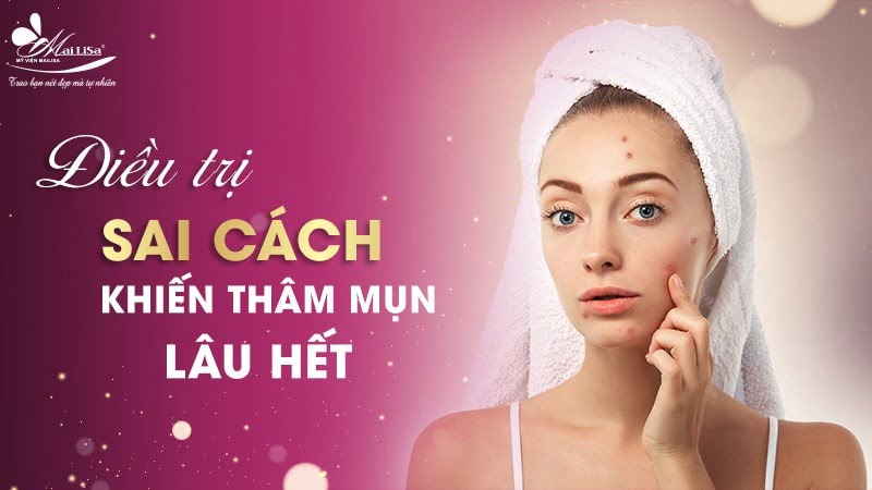 thâm mụn có tự hết không