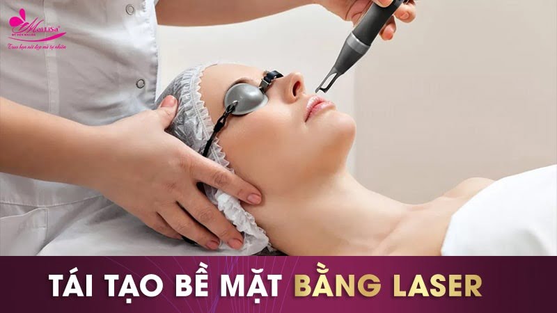 trị sẹo và thâm mụn