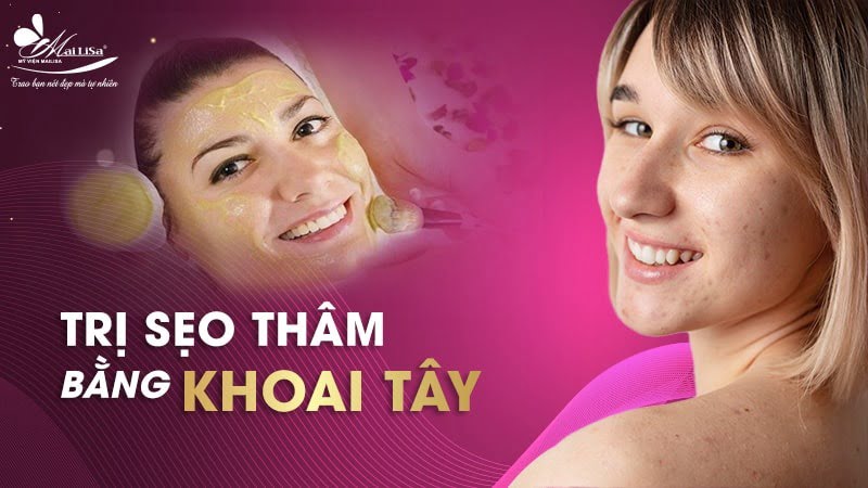 trị sẹo và thâm mụn