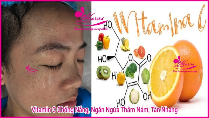 vitamin-ngan-ngua-chong-nang