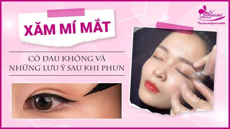 3. Quá trình phục hồi sau khi xăm mí mắt