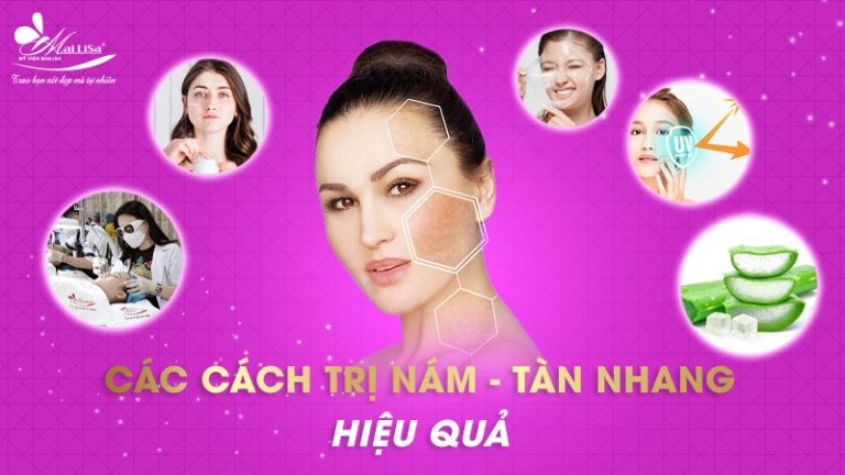 Cách Trị Nám Tàn Nhang Lâu Năm Uy Tín Hiện Nay!