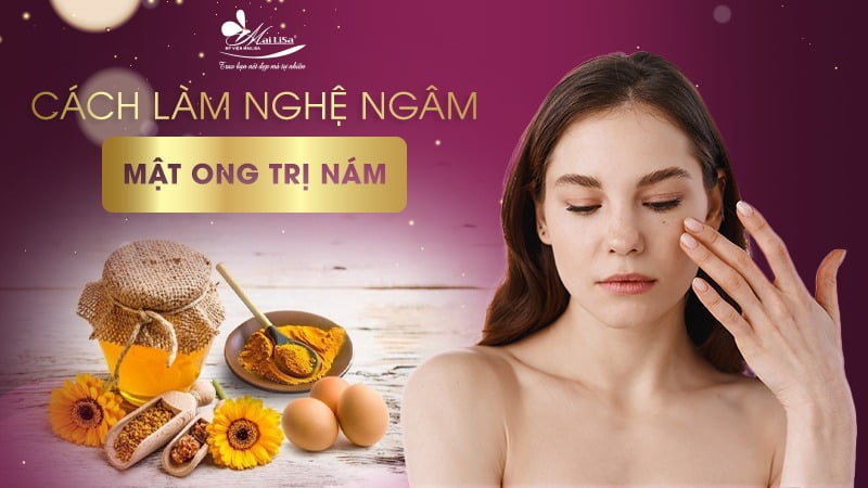 cách trị nám bằng nghệ tươi ngâm mật ong