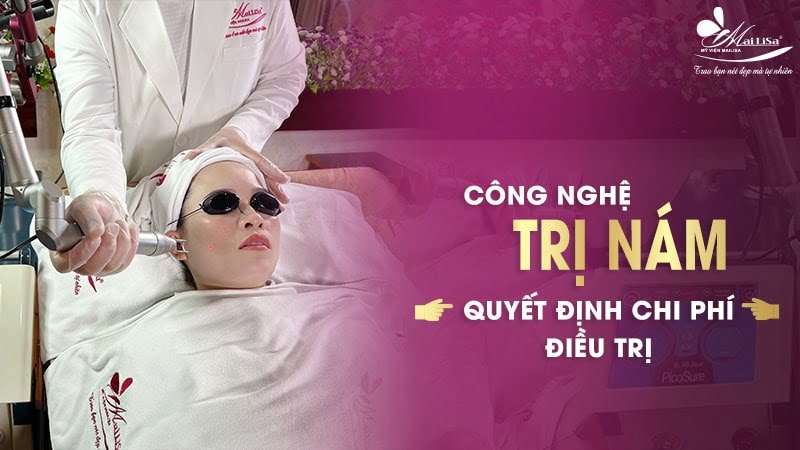 bắn laser trị nám bao nhiêu tiền