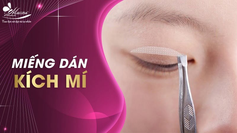 cách kích mí vĩnh viễn