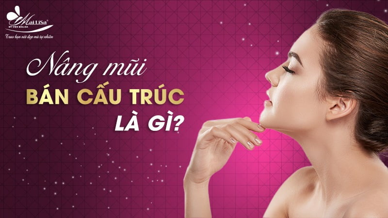 nâng mũi bán cấu trúc