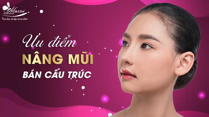 nâng mũi bán cấu trúc