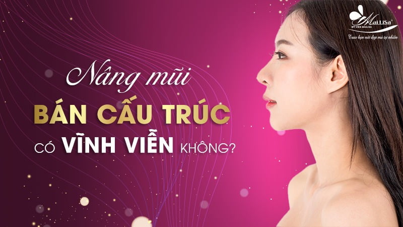 nâng mũi bán cấu trúc