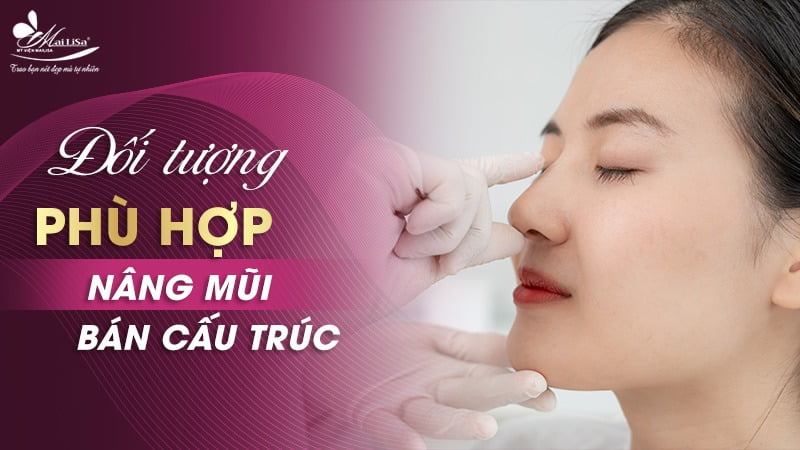 nâng mũi bán cấu trúc