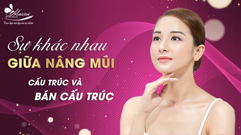 nâng mũi bán cấu trúc