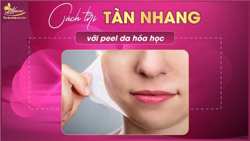 cách trị nám tàn nhang