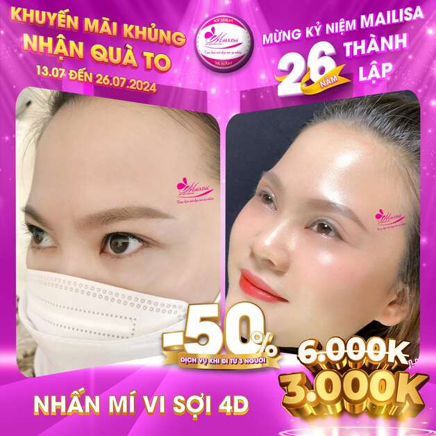 dv_pt nhấn mí-min