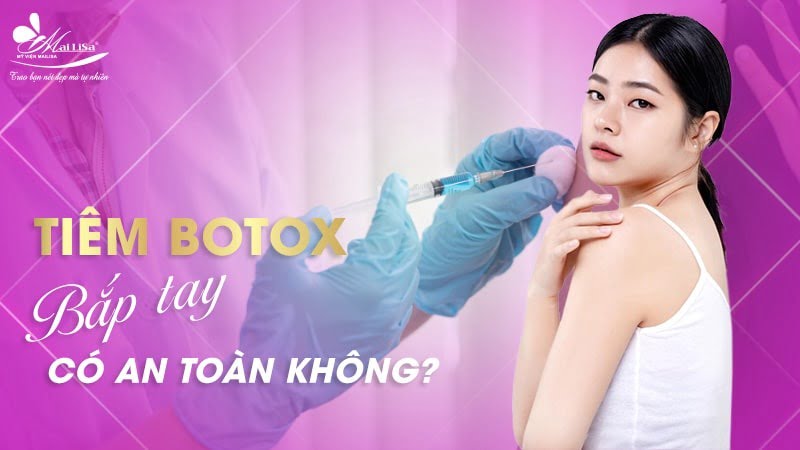 tiêm botox bắp tay