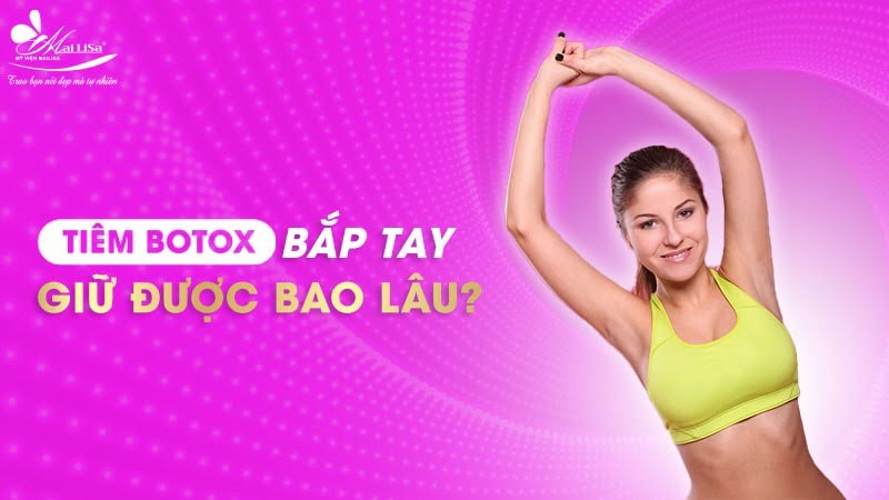 tiêm botox bắp tay