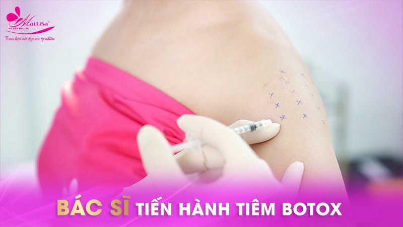 tiêm botox bắp tay